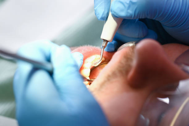 Best Emergency Gum Treatment in Pikeville, KY